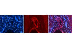 Rabbit Anti-ZFP36L1 Antibody   Formalin Fixed Paraffin Embedded Tissue: Human Liver Tissue Observed Staining: Cytoplasm in smooth muscle cells in portal vein Primary Antibody Concentration: N/A Other Working Concentrations: 1:600 Secondary Antibody: Donkey anti-Rabbit-Cy3 Secondary Antibody Concentration: 1:200 Magnification: 20X Exposure Time: 0. (ZFP36L1 antibody  (Middle Region))