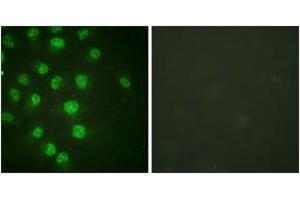 Immunofluorescence analysis of HuvEc cells treated with serum 20% 30', using p57 Kip2 (Phospho-Thr310) Antibody. (CDKN1C antibody  (pThr310))