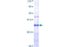 Image no. 1 for Plasminogen Activator, Urokinase Receptor (PLAUR) (AA 25-134) protein (GST tag) (ABIN2565084) (PLAUR Protein (AA 25-134) (GST tag))