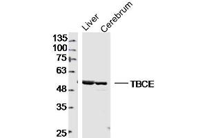 Lane 1: mouse iver lysates Lane 2: mouse cererum lysates probed with TBCE Polyclonal Antibody, Unconjugated  at 1:300 dilution and 4˚C overnight incubation.