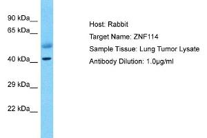 Host: Rabbit Target Name: ZNF114 Sample Type: Lung Tumor lysates Antibody Dilution: 1.