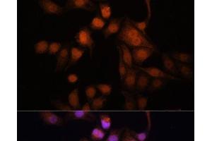 Immunofluorescence analysis of HeLa cells using Twist Polyclonal Antibody at dilution of 1:100. (TWIST1 antibody)