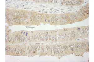 Immunohistochemistry (IHC) image for anti-Spleen tyrosine Kinase (SYK) (AA 250-300) antibody (ABIN7448821)