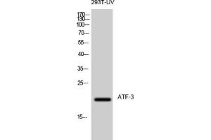 Western Blot analysis of 293T-UV cells using ATF-3 Polyclonal Antibody diluted at 1:500. (ATF3 antibody  (AA 100-180))
