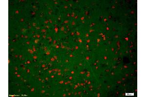 Formalin-fixed and paraffin-embedded rat brain labeled with Anti-Phospho-NMDAR2B (Tyr1070) Polyclonal Antibody, Unconjugated (ABIN744353) 1:200, overnight at 4°C, The secondary antibody was Goat Anti-Rabbit IgG, Cy3 conjugated used at 1:200 dilution for 40 minutes at 37°C. (GRIN2B antibody  (pTyr1070))