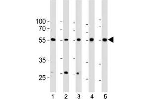 Western blot analysis of lysate from 1) HeLa, 2) K562, 3) MCF-7 cell line, 4) human liver and 5) mouse liver tissue lysate using BMPR1A antibody at 1:1000.