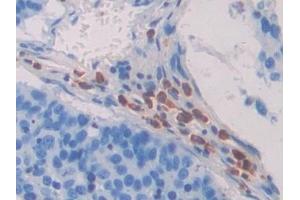 Immunohistochemistry (IHC) image for anti-CD63 (CD63) (AA 103-203) antibody (ABIN7433504)