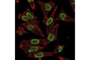 Immunofluorescence staining of PFA-fixed HeLa cells using Histone H1 Rabbit Polyclonal Antibody followed by goat anti-rabbit IgG-CF488 (green). (Histone H1 antibody)