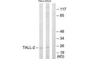 Western blot analysis of extracts from HeLa/COLO205 cells, using TALL-2 Antibody. (TNFSF13 antibody  (AA 151-200))
