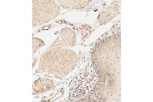 Immunohistochemistry (Paraffin-embedded Sections) (IHC (p)) image for anti-Interleukin 1 alpha (IL1A) (AA 177-206) antibody (ABIN652257)