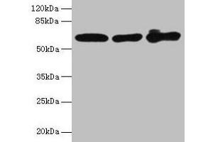 Western blot All lanes: KRT6A antibody at 4 μg/mL Lane 1: A431 whole cell lysate Lane 2: K562 whole cell lysate Lane 3: MCF-7 whole cell lysate Secondary Goat polyclonal to rabbit IgG at 1/10000 dilution Predicted band size: 61 kDa Observed band size: 61 kDa (KRT6A antibody  (AA 2-564))