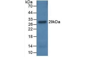 Detection of Recombinant CFH, Rat using Monoclonal Antibody to Complement Factor H (CFH) (Complement Factor H antibody  (AA 975-1217))