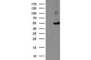 HEK293T cells were transfected with the pCMV6-ENTRY control (Left lane) or pCMV6-ENTRY HARS2 (Right lane) cDNA for 48 hrs and lysed. (HARS2 antibody)