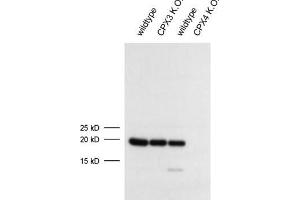 dilution: 1 : 1000 (ECL), sample: mouse retina extract (Complexin 4 antibody)