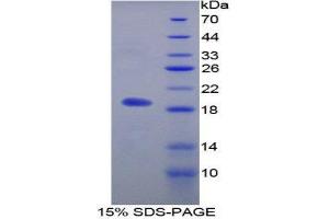 SDS-PAGE (SDS) image for Microfibrillar Associated Protein 5 (MFAP5) (AA 32-164) protein (His tag) (ABIN2125866)