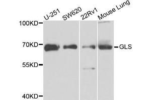 Western blot analysis of extracts of various cell lines, using GLS antibody. (Glutaminase antibody)