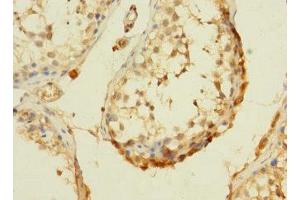 Immunohistochemistry of paraffin-embedded human testis tissue using ABIN7166755 at dilution of 1:100 (DHX32 antibody  (AA 301-500))