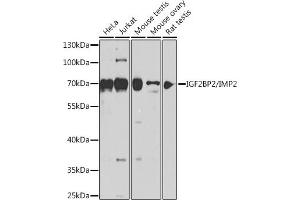 Western blot analysis of extracts of various cell lines, using IGF2BP2/IMP2 antibody (ABIN6134718, ABIN6142241, ABIN6142243 and ABIN6218347) at 1:1000 dilution. (IGF2BP2 antibody  (C-Term))