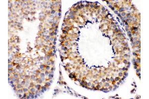 Smac/Diablo was detected in paraffin-embedded sections of mouse testis tissues using rabbit anti- Smac/Diablo Antigen Affinity purified polyclonal antibody at 1 μg/mL.