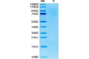 Mouse PSGL-1 on Tris-Bis PAGE under reduced condition. (SELPLG Protein (AA 42-307) (His tag))