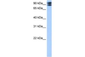 Western Blotting (WB) image for anti-C2CD2-Like (C2CD2L) antibody (ABIN2463042) (C2CD2L antibody)