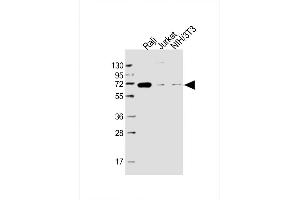 Lane 1: Raji, Lane 2: Jurkat, Lane 3: NIH/3T3 cell lysate at 20 µg per lane, probed with bsm-51381M RELB (1684CT450. (RELB antibody)