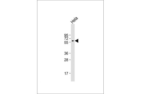 ACVR1 Antikörper  (AA 85-123)