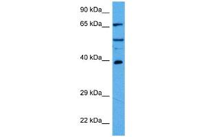 Host:  Rabbit  Target Name:  HDAC2  Sample Tissue:  Mouse Pancreas  Antibody Dilution:  1ug/ml (HDAC2 antibody  (C-Term))