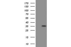 HEK293T cells were transfected with the pCMV6-ENTRY control (Left lane) or pCMV6-ENTRY EIF2S1 (Right lane) cDNA for 48 hrs and lysed. (EIF2S1 antibody)