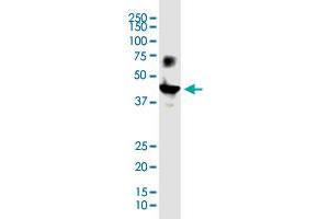 VSTM1 monoclonal antibody (M03), clone 2E12. (VSTM1 antibody  (AA 1-174))