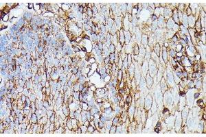 Immunohistochemistry of paraffin-embedded Human esophageal using HLA-B Polyclonal Antibody at dilution of 1:100 (40x lens). (HLA-B antibody)