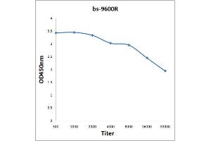 Antigen: 2 µg/100 µL  Primary: Antiserum, 1:500, 1:1000, 1:2000, 1:4000, 1:8000, 1:16000, 1:32000;  Secondary: HRP conjugated Rabbit Anti-Goat IgG at 1: 5000;  TMB staining Read the data in Microplate Reader by 450nm. (STIP1 antibody)