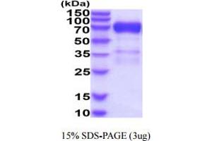SDS-PAGE (SDS) image for Glypican 3 (GPC3) (AA 25-559) protein (His tag) (ABIN5854889)