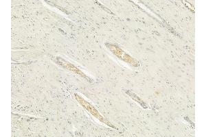 ABIN6260673 and ABIN6276631 at 1/100 staining human pancreatic carcinoma by IHC-P. (CDC20 antibody  (N-Term))