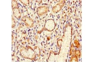 anti-Intraflagellar Transport 80 Homolog (IFT80) (AA 1-268) antibody