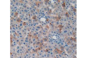 Used in DAB staining on fromalin fixed paraffin- embedded liver tissue (MYO1F antibody  (AA 655-922))
