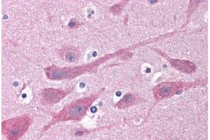 Human Brain, Cortex: Formalin-Fixed, Paraffin-Embedded (FFPE) (GABRB1 antibody  (AA 1-226))