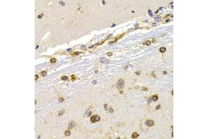 Immunohistochemistry of paraffin-embedded rat brain using EEF1D antibody (ABIN3023318, ABIN3023319, ABIN3023320 and ABIN6219589) at dilution of 1:200 (40x lens). (EEF1D antibody  (AA 1-160))