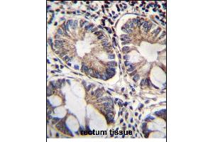 ME2 Antibody (C-term) (ABIN656541 and ABIN2845805) immunohistochemistry analysis in formalin fixed and paraffin embedded human rectum tissue followed by peroxidase conjugation of the secondary antibody and DAB staining.