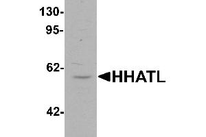 Western blot analysis of HHATL in 3T3 cell lysate with HHATL antibody at 1 µg/mL. (HHATL antibody  (N-Term))
