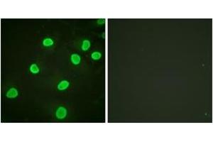 Immunofluorescence analysis of HeLa cells, using Histone H4 (Acetyl-Lys5) Antibody. (Histone H4 antibody  (acLys5))