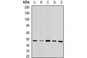 Western blot analysis of UQCRC2 expression in MCF7 (A), HepG2 (B), mouse brain (C), mouse liver (D), rat testis (E) whole cell lysates. (UQCRC2 antibody)