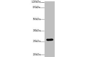 Western blot All lanes: TMEM217 antibody at 10 μg/mL + Jurkat whole cell lysate Secondary Goat polyclonal to rabbit IgG at 1/10000 dilution Predicted band size: 27, 25 kDa Observed band size: 27 kDa (TMEM217 antibody  (AA 150-211))
