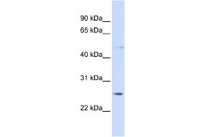 WB Suggested Anti-RNF170 Antibody Titration:  0.