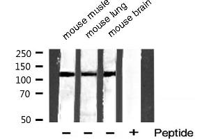 Western blot analysis of extracts of various smaple,using Phospho-HDAC5 (Ser259) Antibody. (HDAC5 antibody  (pSer259))