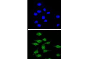 Confocal immunofluorescent analysis of AIRE Antibody (Center) with 293 cell followed by Alexa Fluor® 488-conjugated goat anti-rabbit lgG (green). (AIRE antibody  (Middle Region))