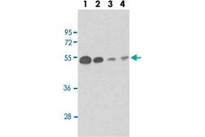 Western blot analysis of Lane 1: mouse brain tissue lysates Lane 2: Y79 whole cell lysates Lane 3: CEM whole cell lysates Lane 4: 293 whole cell lysates reacted with TUBB1 monoclonal antibody  at 1:100-1:500 dilution. (TUBB1 antibody)