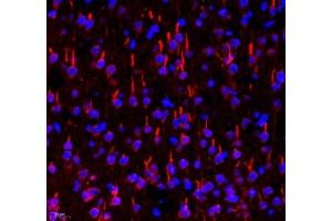 Immunofluorescent analysis of paraformaldehyde-fixed rat brain using TRIM46 (ABIN7076020) at dilution of 1: 3200 (TRIM46 antibody)