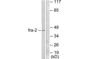 Western blot analysis of extracts from LOVO cells, using Fra-2 antibody (ABIN5976401).