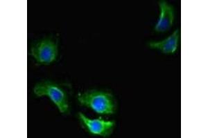 Immunofluorescent analysis of A549 cells using ABIN7172144 at dilution of 1:100 and Alexa Fluor 488-congugated AffiniPure Goat Anti-Rabbit IgG(H+L)